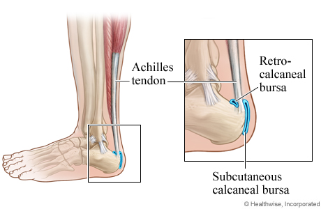 Retrocalcaneal and subcutaneous calcaneal bursa