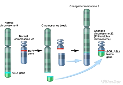 Philadelphia chromosome; three-panel drawing shows a piece of chromosome 9 and a piece of chromosome 22 breaking off and trading places, creating a changed chromosome 22 called the Philadelphia chromosome. In the left panel, the drawing shows a normal chromosome 9 with the ABL1 gene and a normal chromosome 22 with the BCR gene. In the center panel, the drawing shows part of the ABL1 gene breaking off from chromosome 9 and a piece of chromosome 22 breaking off, below the BCR gene. In the right panel, the drawing shows chromosome 9 with the piece from chromosome 22 attached. It also shows a shortened version of chromosome 22 with the piece from chromosome 9 containing part of the ABL1 gene attached. The ABL1 gene joins to the BCR gene on chromosome 22 to form the BCR::ABL1 fusion gene. The changed chromosome 22 with the BCR::ABL1 fusion gene on it is called the Philadelphia chromosome.