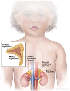 Anatomía de la glándula suprarrenal. En la imagen del abdomen se muestran las glándulas suprarrenales izquierda y derecha, los riñones izquierdo y derecho y los vasos sanguíneos mayores. En el recuadro se observa una sección de la glándula suprarrenal que muestra la corteza suprarrenal y la médula suprarrenal.