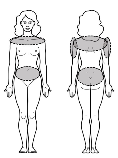 diagram showing where to put patch