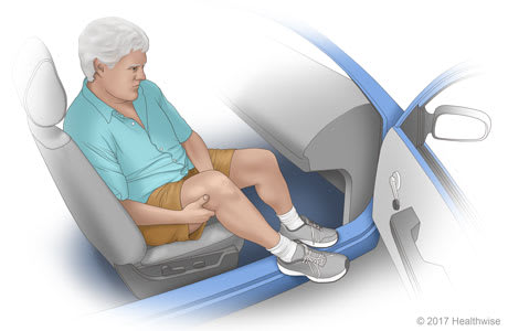 How to lift leg into car. How to lift leg into car.