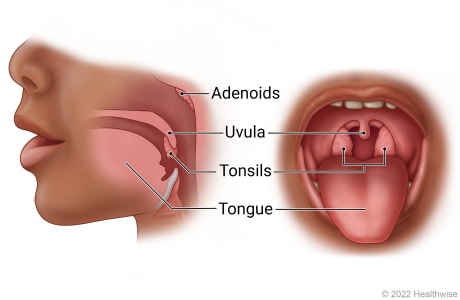 Tonsils, adenoids, and uvula
