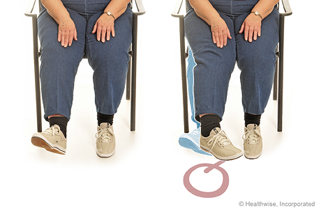 Alphabet range-of-motion exercise for an ankle sprain. Alphabet range-of-motion exercise for an ankle sprain.