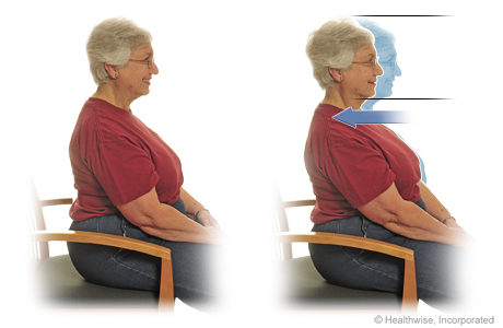 Seated exercise: Chin tuck (or dorsal glide). Seated exercise: Chin tuck (or dorsal glide).
