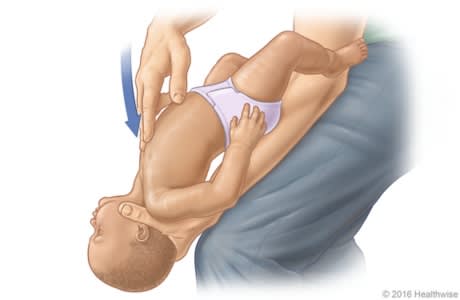 Choking rescue procedure (Heimlich manoeuvre) for a small child.