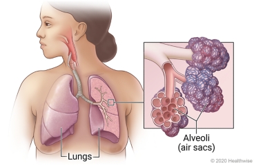 Location of lungs in chest, with inside view of lung and detail of alveoli (air sacs) at ends of airways.