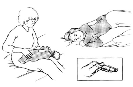 Drenaje postural para los lóbulos inferiores (costados)