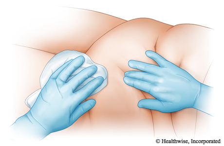 Levante y aplane la piel para lavar debajo de los pliegues de la piel.