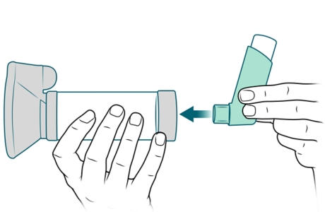 Mouthpiece of inhaler being placed into spacer.