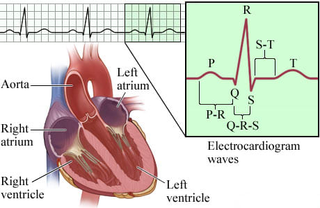 Picture of the intervals and components of an EKG (electrocardiogram)