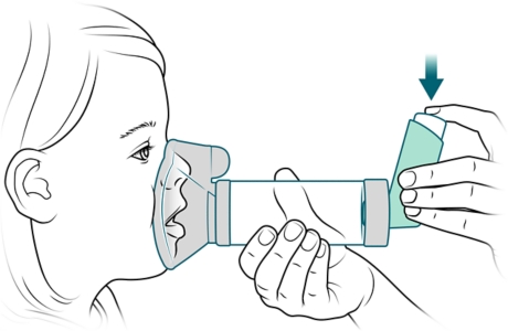 Una persona presiona un inhalador para rociar medicamento dentro del espaciador.