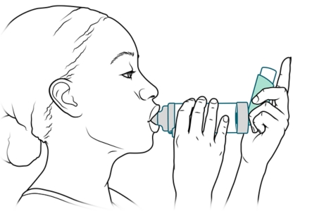 Persona con la boquilla del espaciador en la boca.