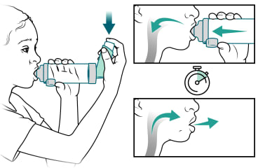 El niño presiona el inhalador mientras inspira por la boquilla y luego espira.