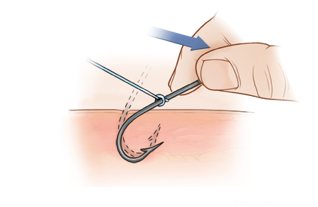 Paso B: Sostenga el anzuelo con los dedos y presione hacia abajo