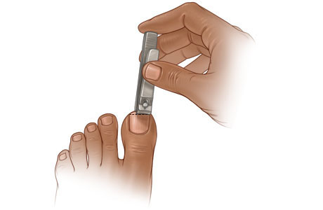 Imagen de cómo cortar las uñas de los dedos de los pies