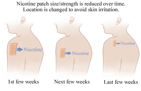 Changes in size and placement of nicotine patch over time.