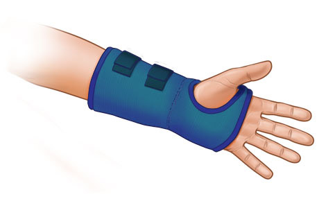 Wrist splint