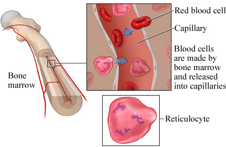 Picture of reticulocytes