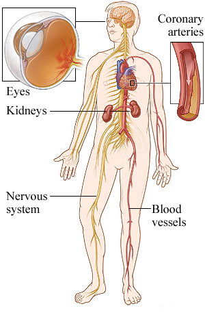 Body areas affected by diabetes